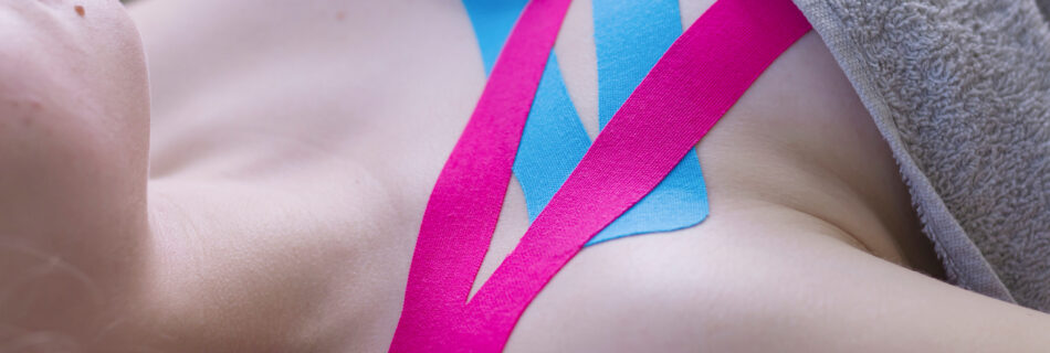 Kinesiotherapy,,Taping,In,The,Chest,Area.,Lifting,,Pull up,,Volume,Reduction,